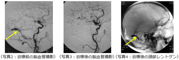 院長コラム：耳鳴り(4)