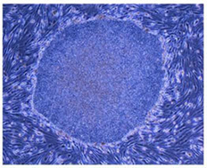 院長コラム：神経難病