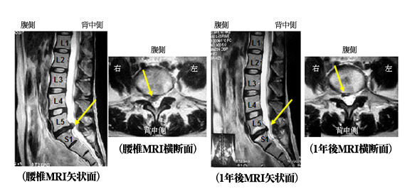 院長コラム：腰痛について(2)