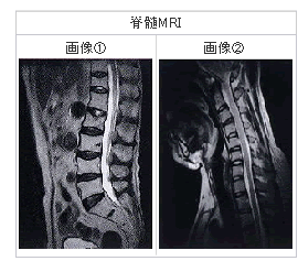 頸動脈エコー装置