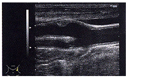 ABPI検査結果出力例